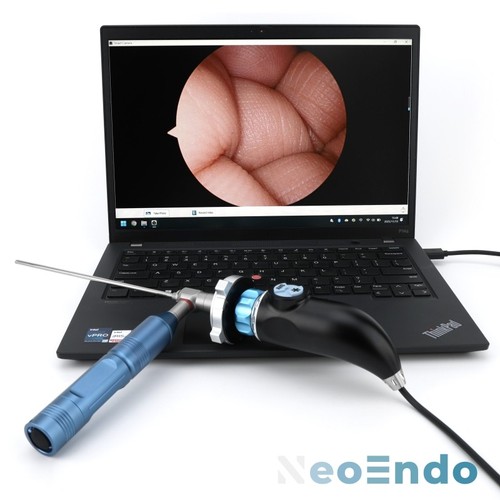 Portable medical usb endoscope - medical,