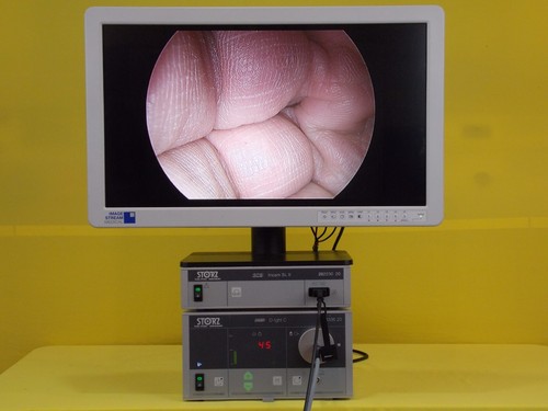 Storz pdd cystoscopy tricam - storz,